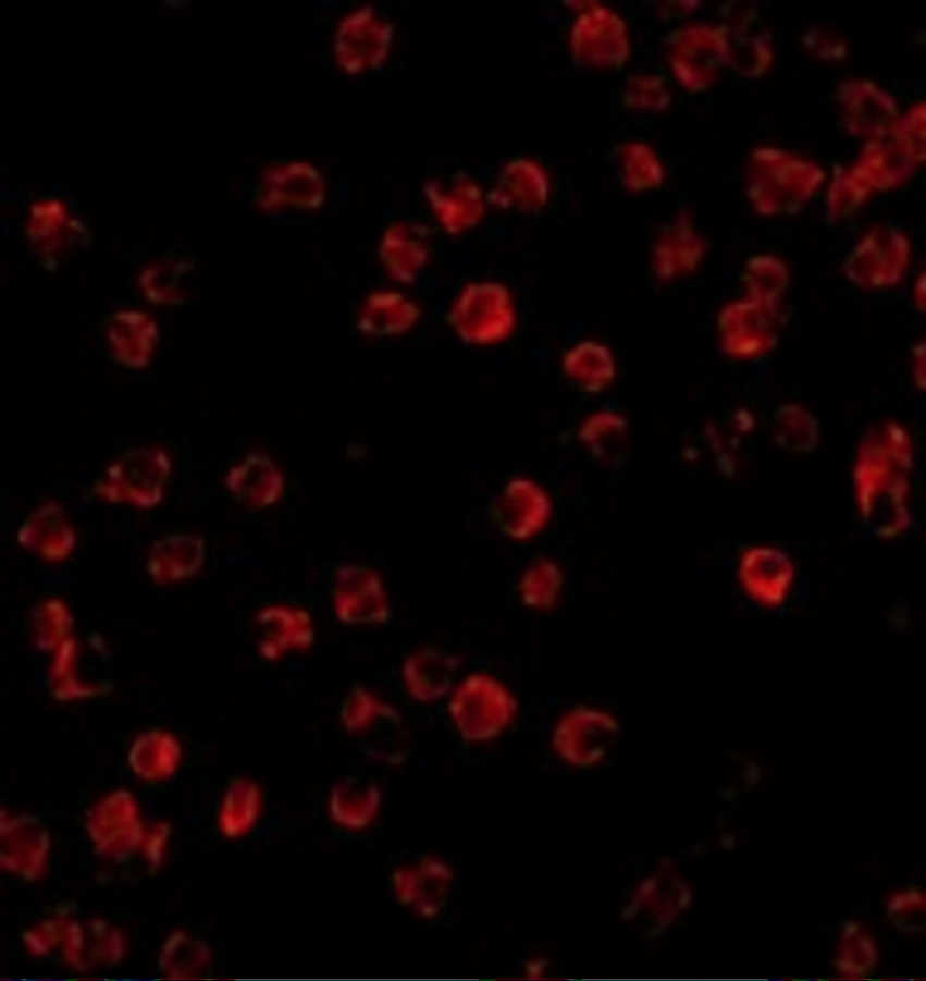 BTK Antibody