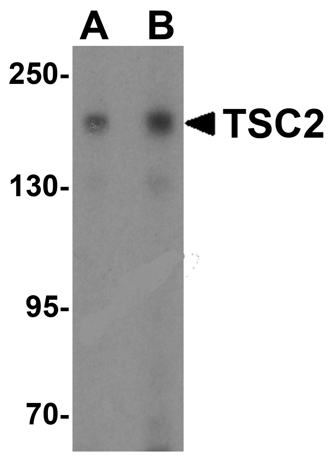 TSC2 Antibody