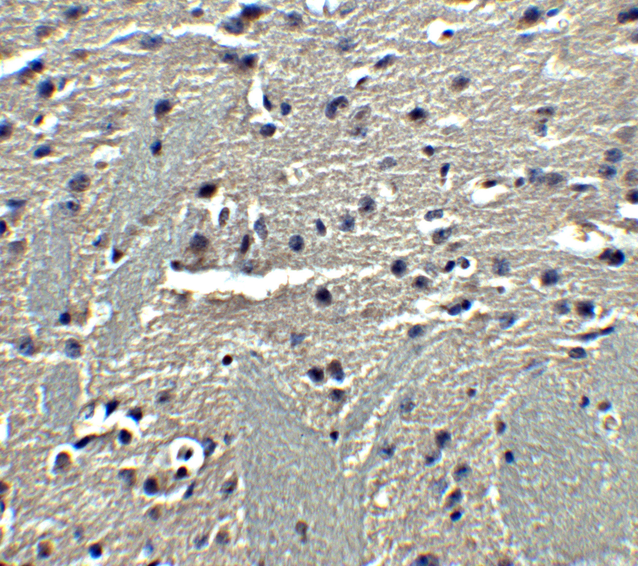 Adiponectin Antibody