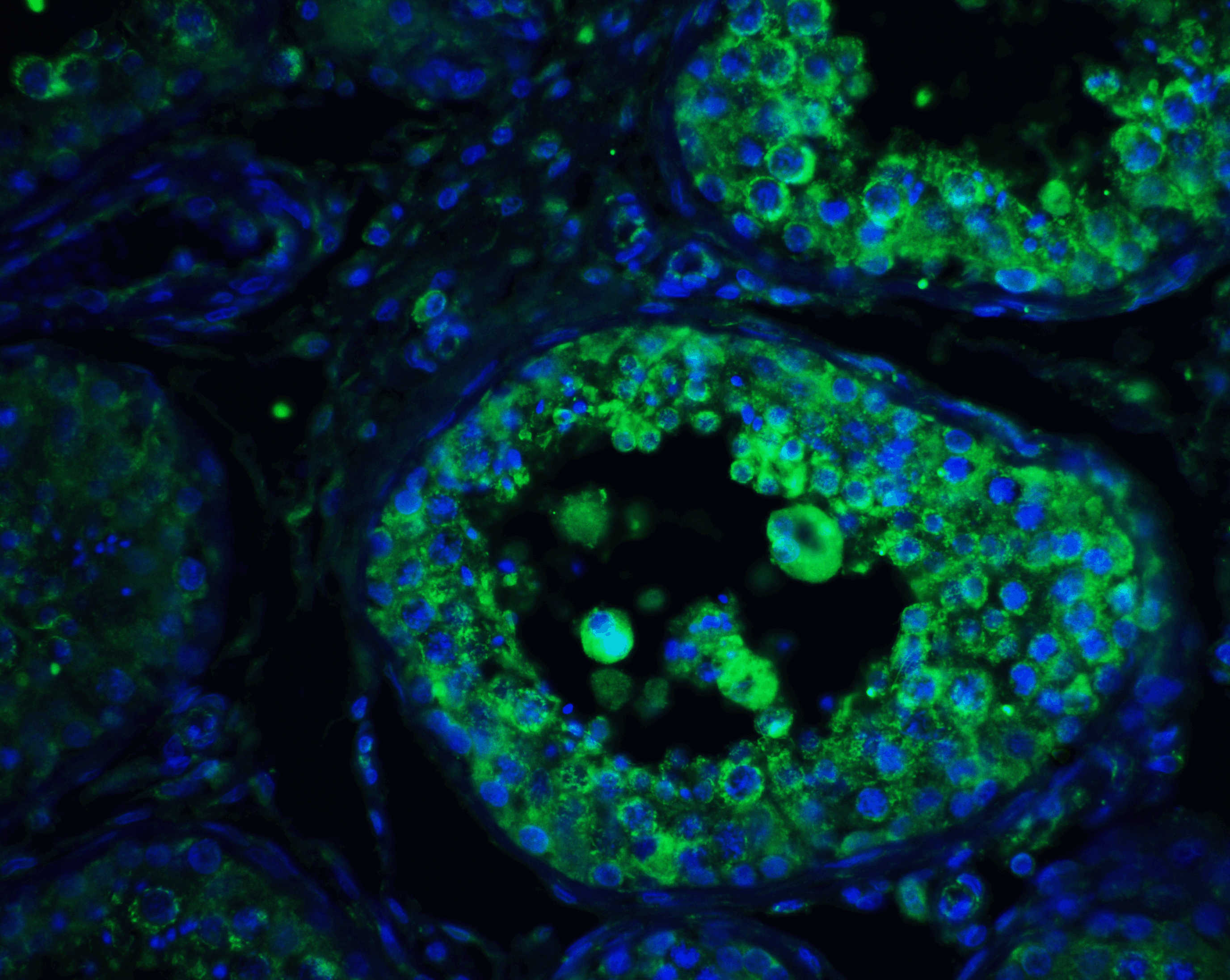 PIST Antibody