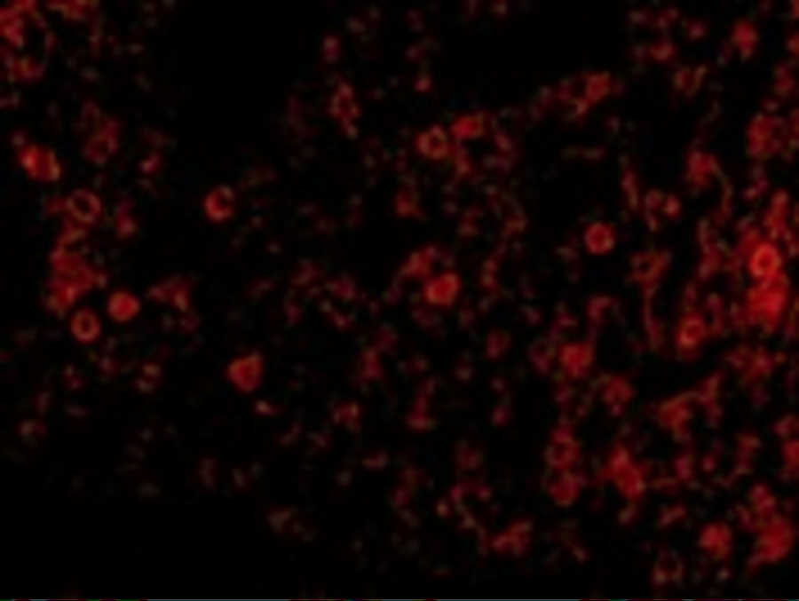 PKR Antibody