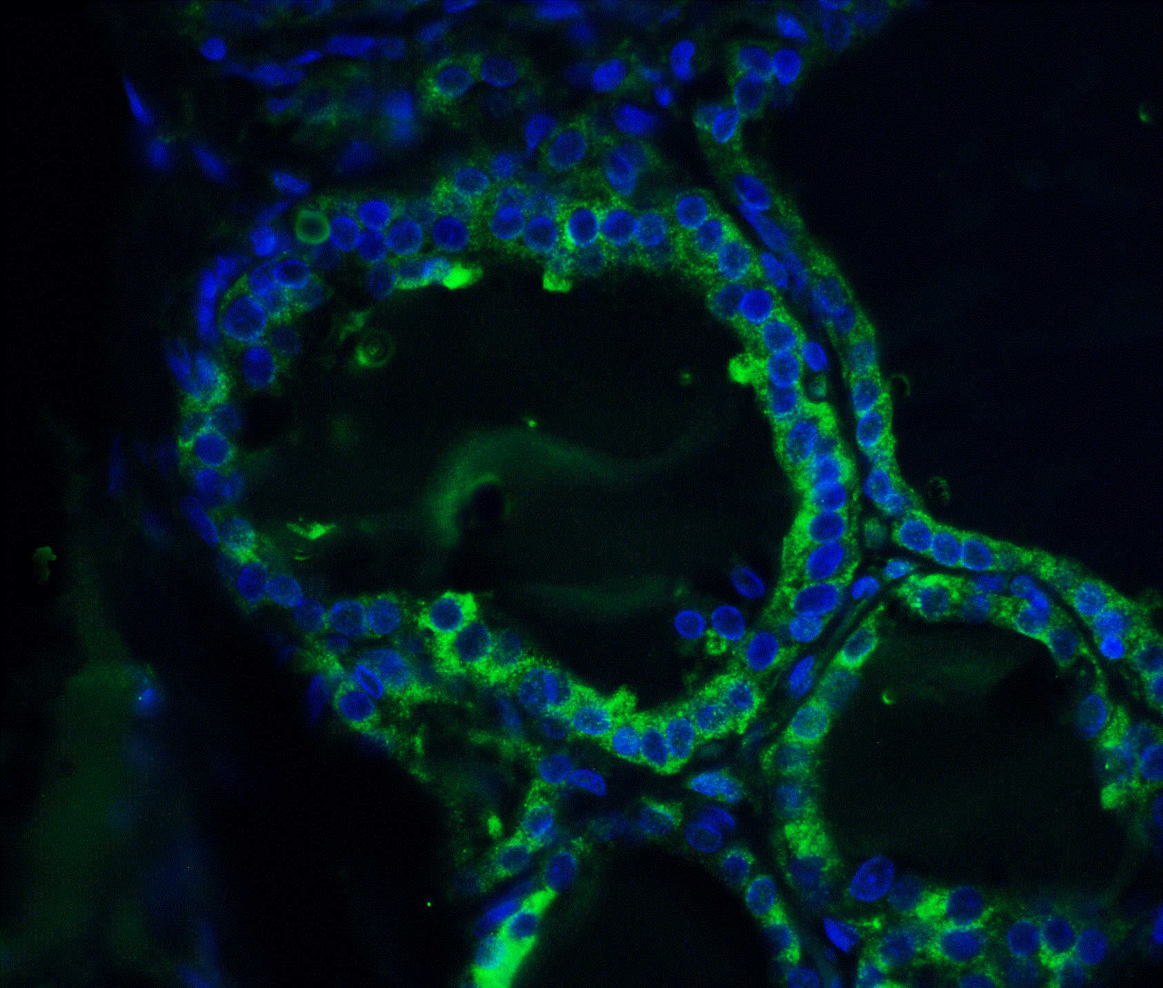 ORAI1 Antibody