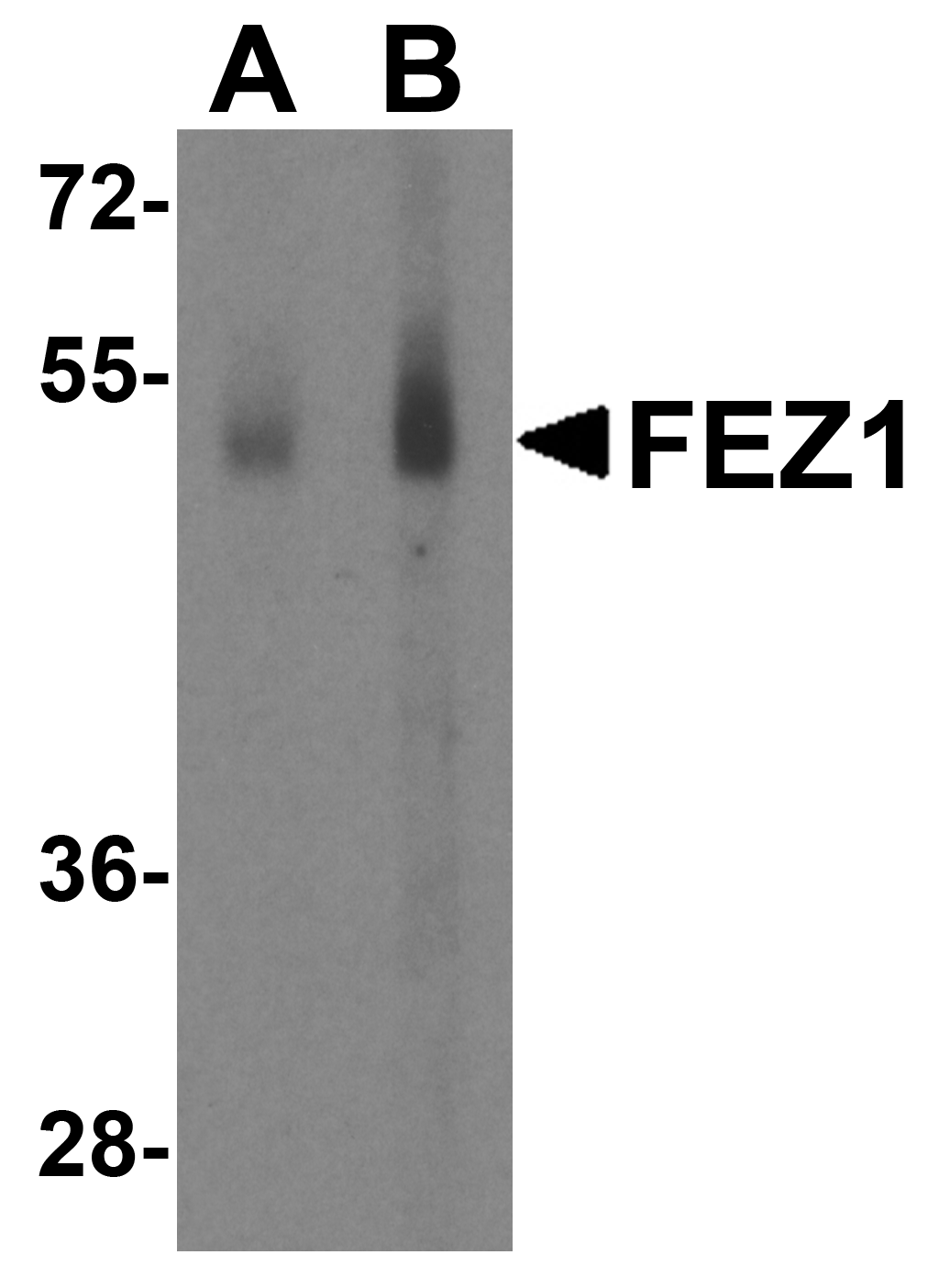FEZ1 Antibody