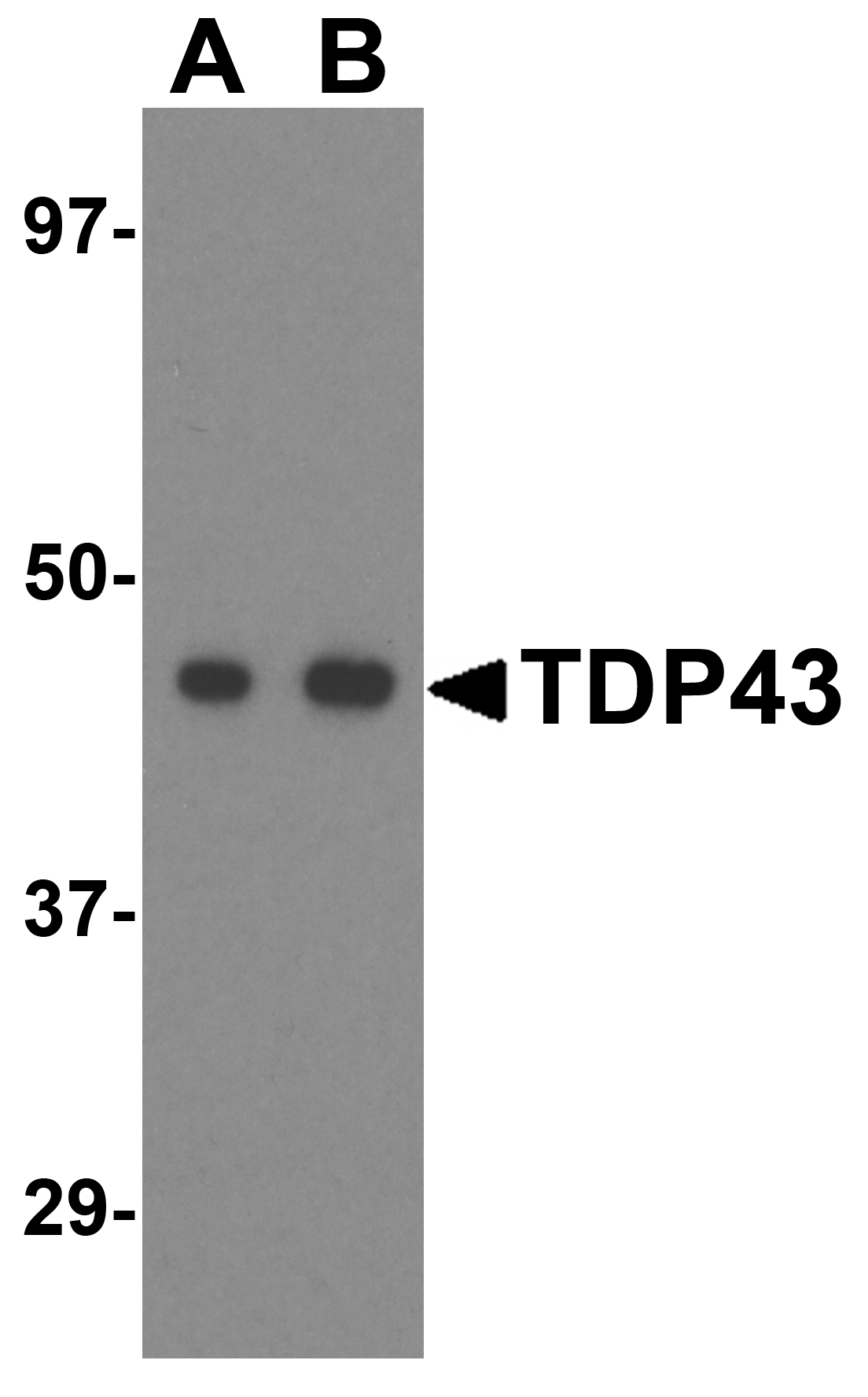 TDP43 Antibody