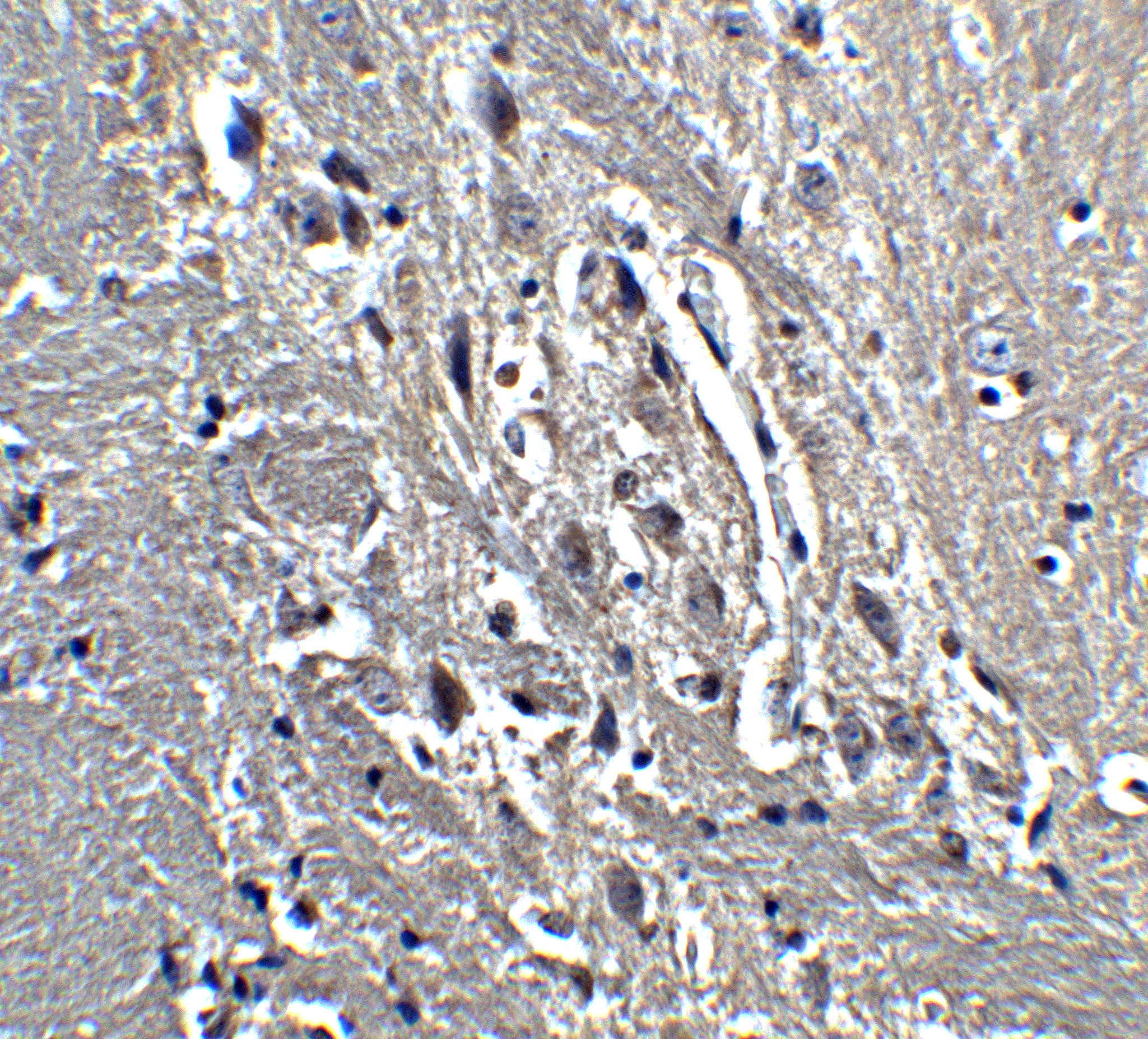 KIF5 Antibody