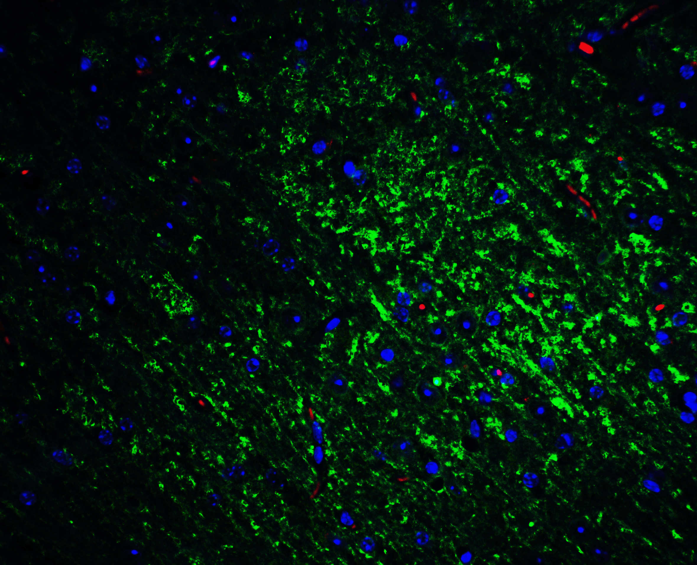 Slitrk1 Antibody