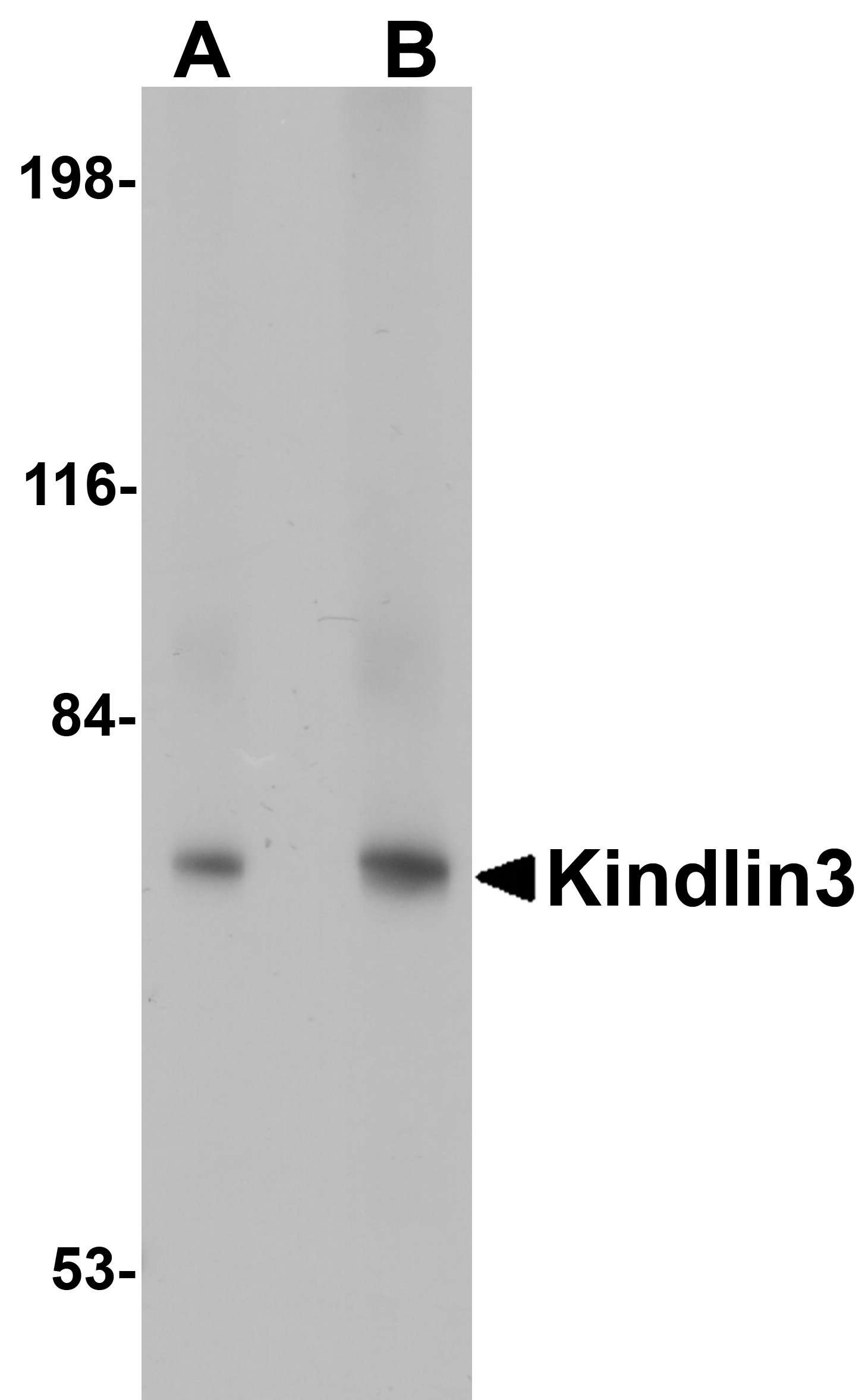KINDLIN3 Antibody