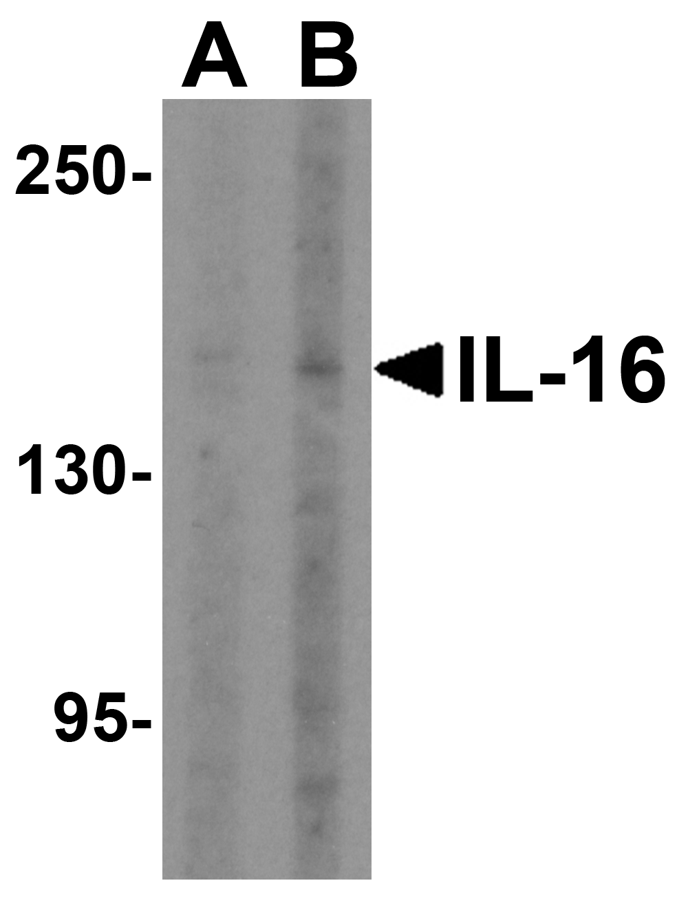 IL6 Antibody