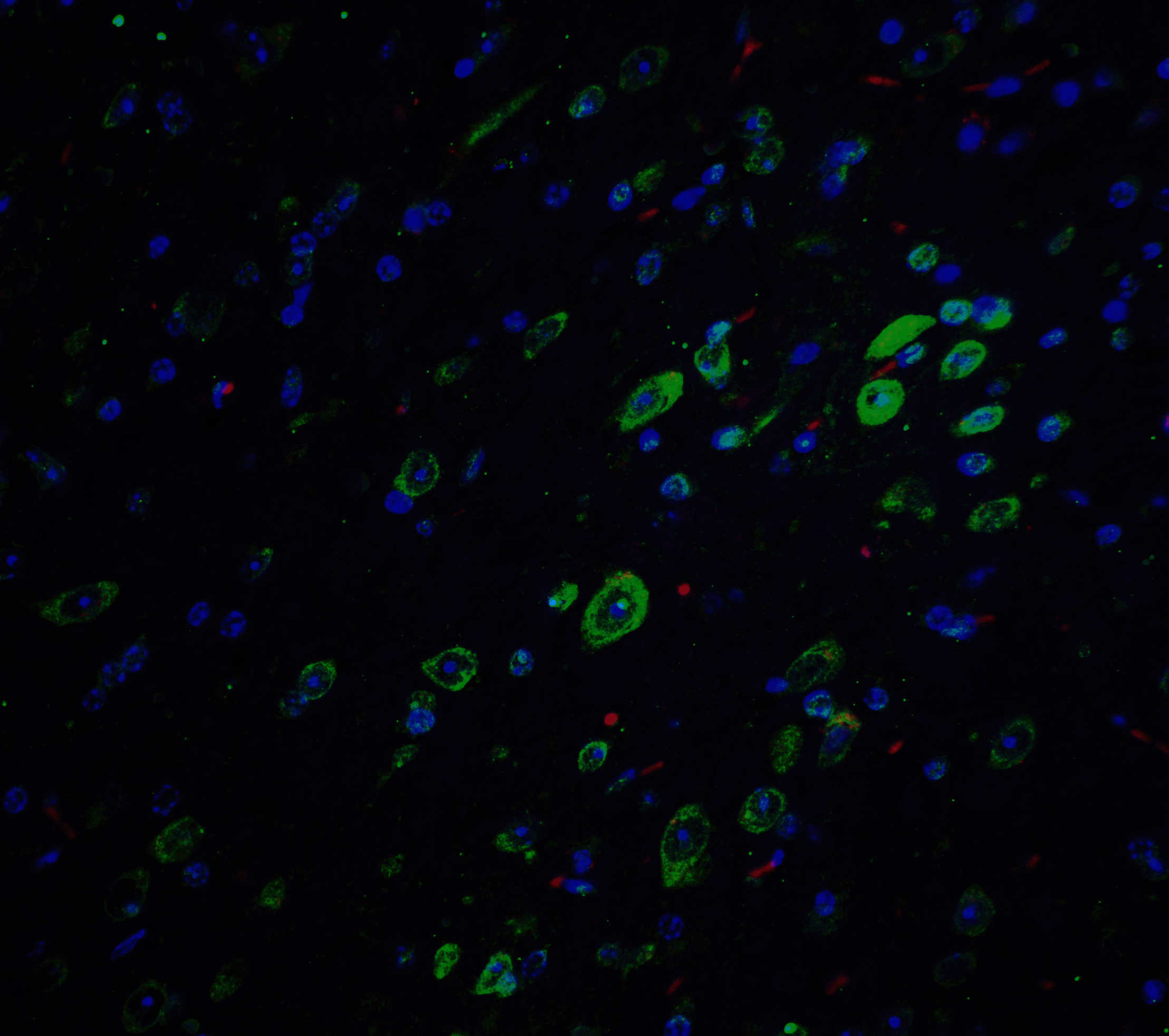 APP Antibody