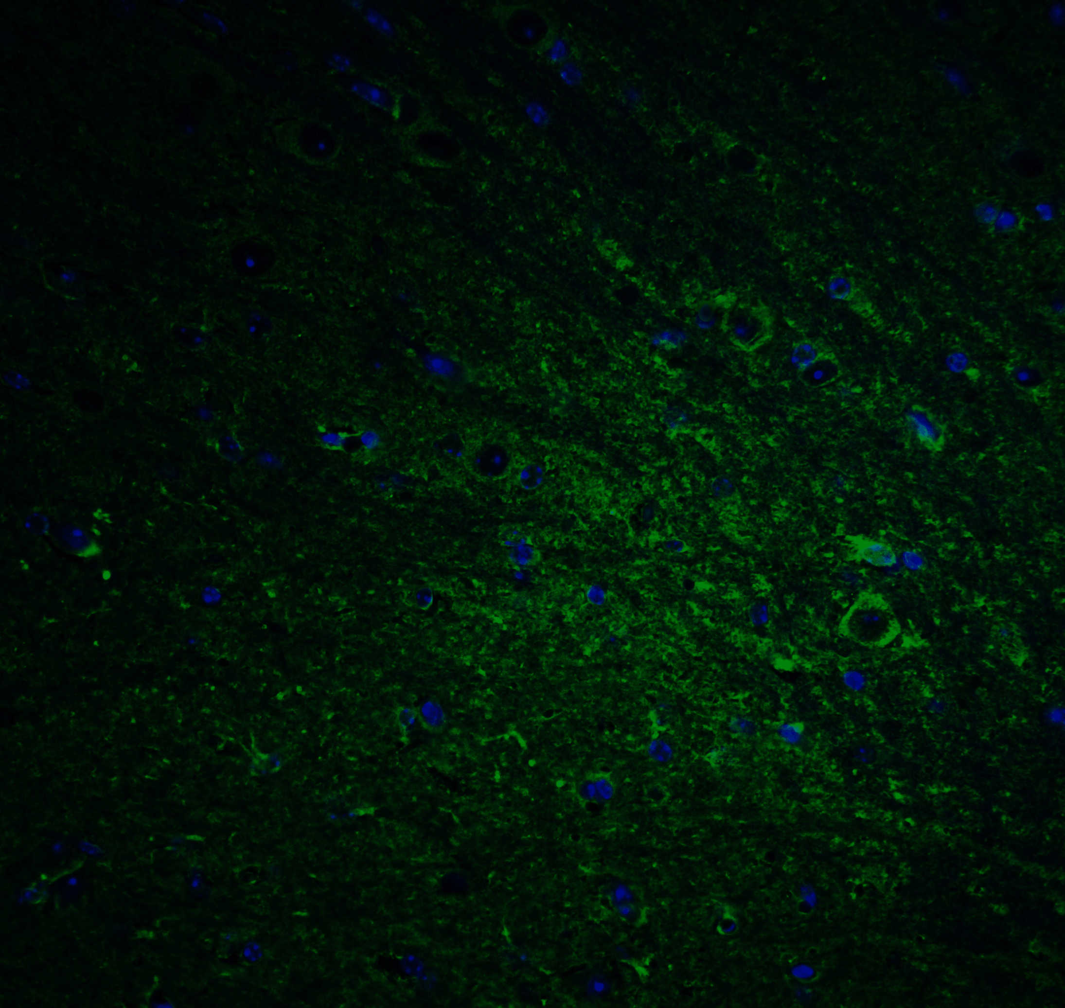 DCLK1 Antibody
