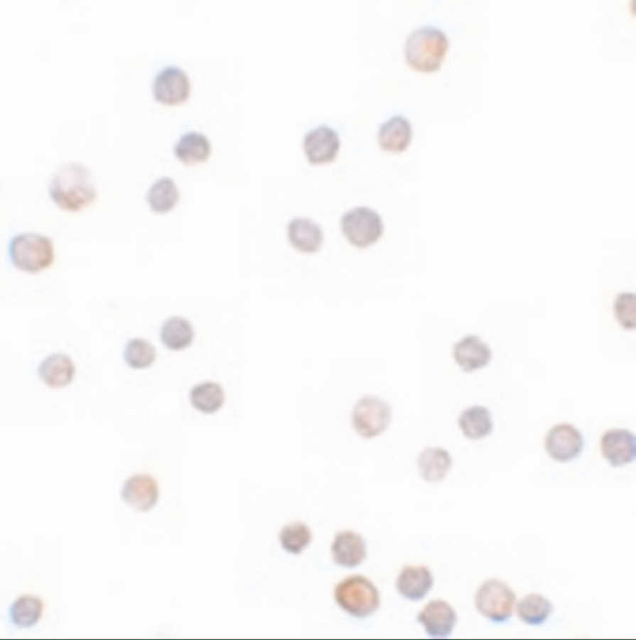 ZEB1 Antibody