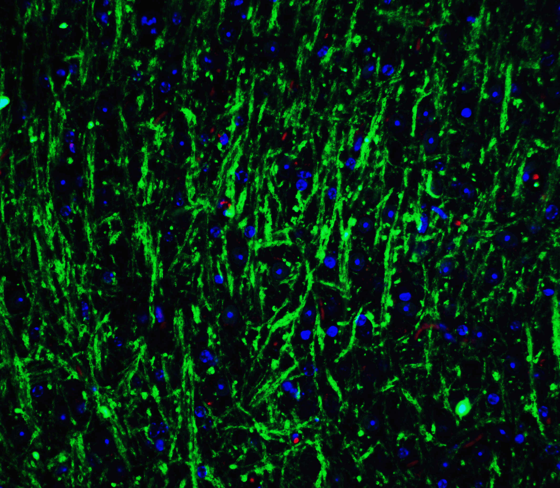 MSI2 Antibody