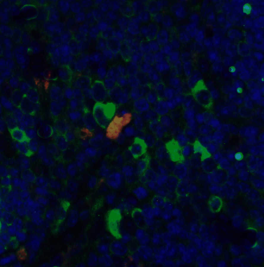 CD4 Monoclonal Antibody