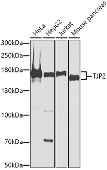 TJP2 Polyclonal Antibody