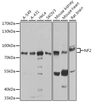 [KO Validated] NF2 Polyclonal Antibody