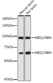 [KO Validated] NBN Polyclonal Antibody