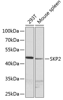 SKP2 Polyclonal Antibody