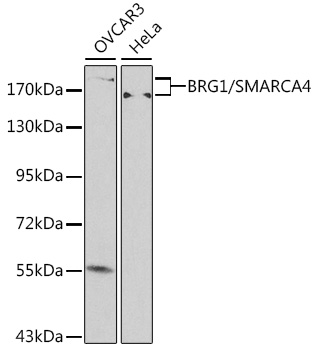 [KO Validated] SMARCA4 Polyclonal Antibody
