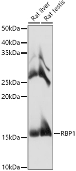 RBP1 Polyclonal Antibody