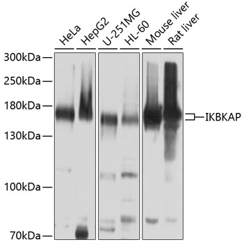IKBKAP Polyclonal Antibody