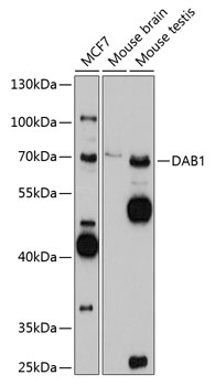 DAB1 Polyclonal Antibody