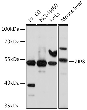 SLC39A8 Polyclonal Antibody