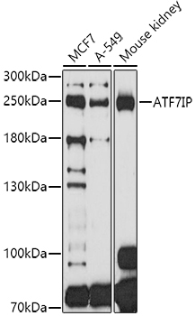 ATF7IP Polyclonal Antibody