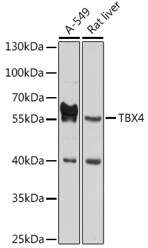 TBX4 Polyclonal Antibody