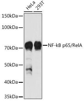 [KO Validated] NF-kB p65 Polyclonal Antibody