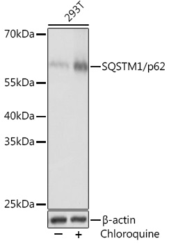 SQSTM1 Polyclonal Antibody