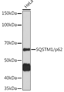SQSTM1 / p62 Polyclonal Antibody