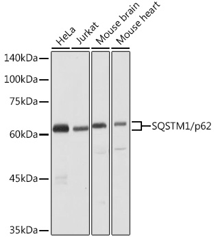 SQSTM1 / p62 Polyclonal Antibody