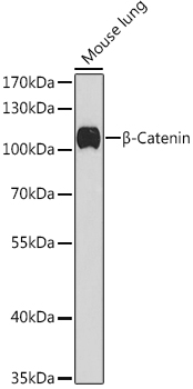 [KO Validated] beta Catenin Polyclonal Antibody