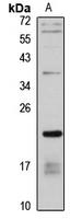 DESI2 Polyclonal Antibody