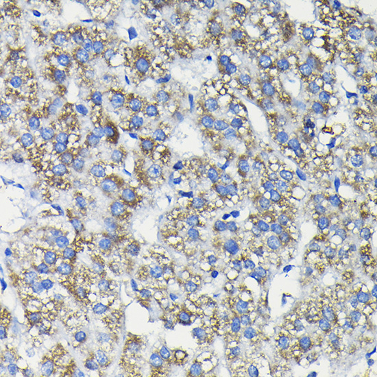 FUCA2 Polyclonal Antibody