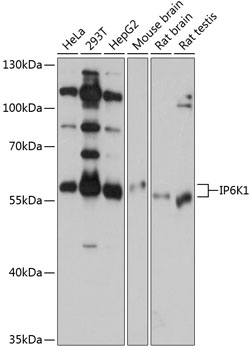 IP6K1 Polyclonal Antibody