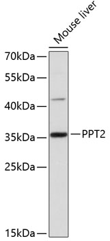 PPT2 Polyclonal Antibody