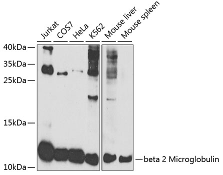 [KO Validated] beta 2 Microglobulin Polyclonal Antibody