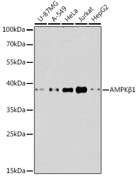 [KO Validated] PRKAB1 Polyclonal Antibody