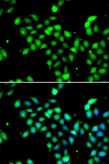 METTL13 Polyclonal Antibody