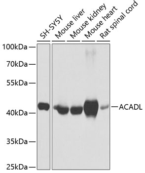 ACADL Polyclonal Antibody