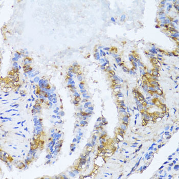 NAT2 Polyclonal Antibody