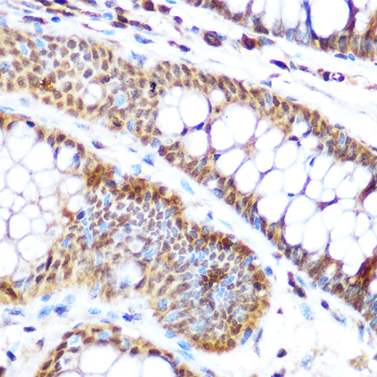 SP3 Polyclonal Antibody