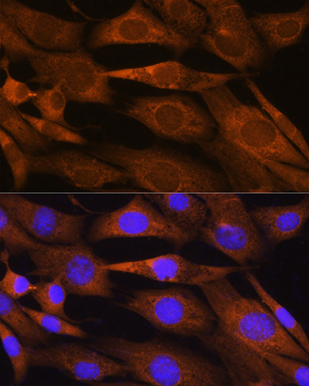 PHOSPHO2 Polyclonal Antibody