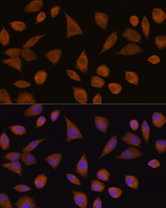 CRYZ Polyclonal Antibody
