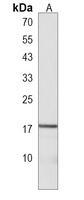 LYPD1 Polyclonal Antibody