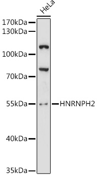 HNRNPH2 Polyclonal Antibody