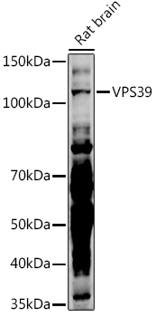 VPS39 Polyclonal Antibody