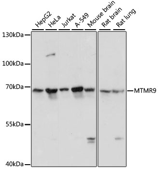 MTMR9 Polyclonal Antibody