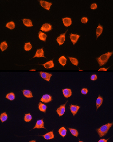 SCYL2 Polyclonal Antibody